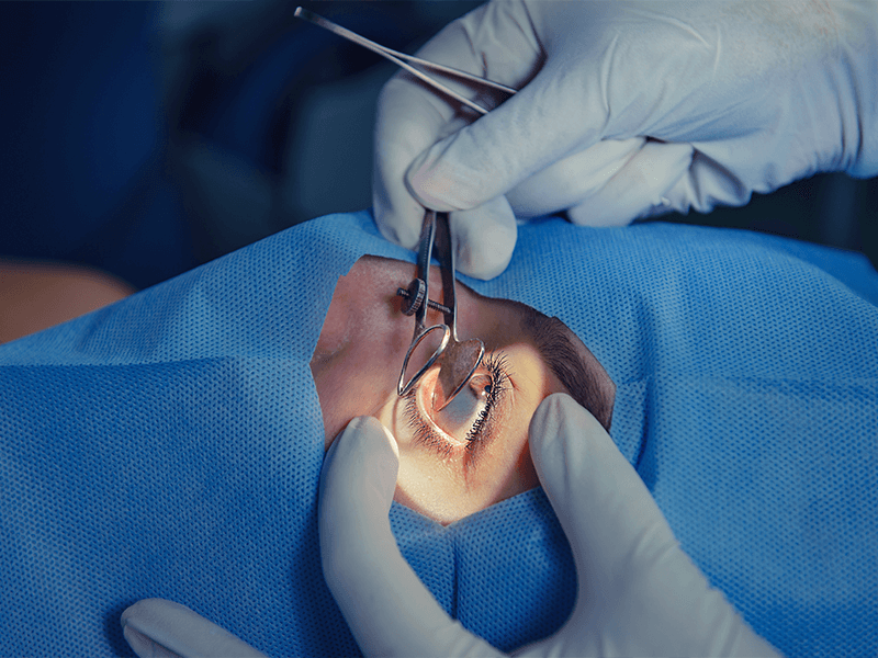 Cirugía de retina – Dr Monges Liniers